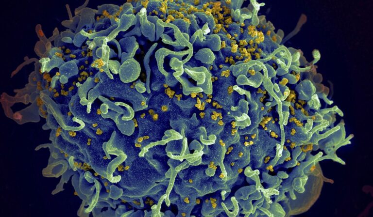 Two new cases of HIV recovery give scientists hope for a broadly usable cure